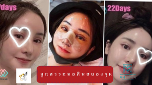 ลูกสาวหมอคิมฮยองจุน “คลอดแล้วจ้า”