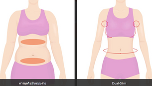 Dual – Slim ศัลยกรรมลดขนาดรูปร่างให้เป๊ะ