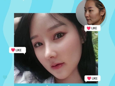 ทำจมูก ก็อยากให้สวยจบภายในครั้งเดียว