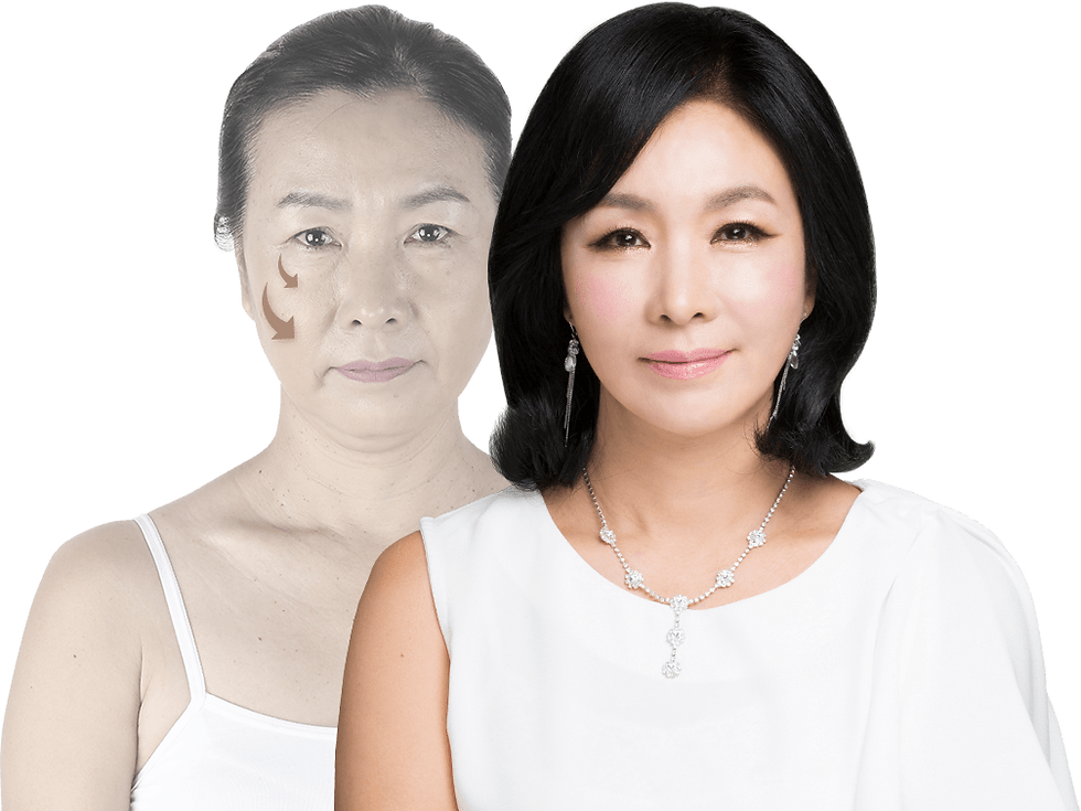 banobagi plastic surgery model