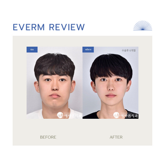รีวิวผ่าตัดขากรรไกรและโครงหน้า