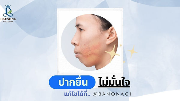 “ปากยื่น” ไม่มั่นใจแก้ไขได้ @Banobagi