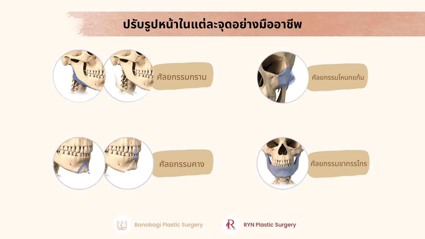 ผ่าตัดปรับโครงหน้าเพิ่มเสน่ห์ให้ผู้ชาย ที่บาโนบากิ