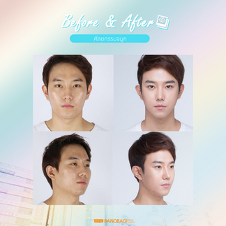 โรงพยาบาลบาโนบากิ (Banobagi Plastic Surgery)