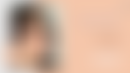 รีวิวศัลยกรรมแก้จมูก คุณฟาริดา