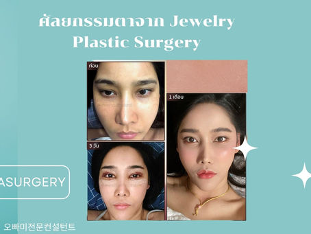 รีวิวศัลยกรรมตา