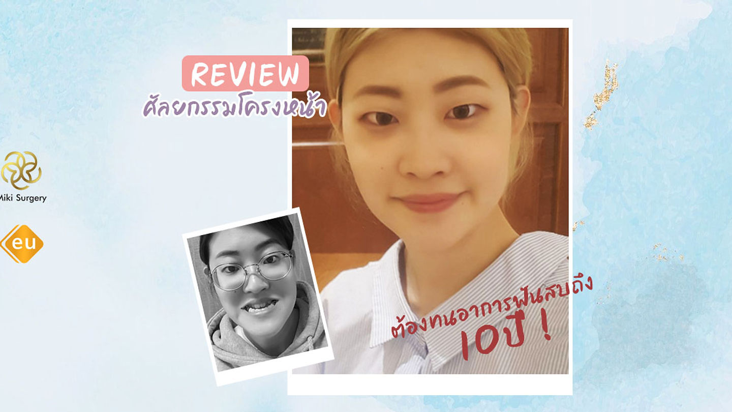 รีวิวศัลยกรรมสุดว้าวของสาวที่มีอาการสบฟันตั้งแต่มัธยม จนได้คุณหมอฮีจินผู้มีพรสวรรค์ให้เธอได้มีชีวิตท (ตอนที่ 2)