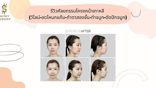 รีวิวการเปลี่ยนแปลงที่น่าทึ่งของ คุณLee (ตอนที่ 1)
