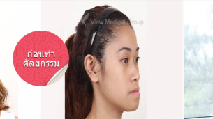 ศัลยกรรมเปลี่ยนใบหน้า