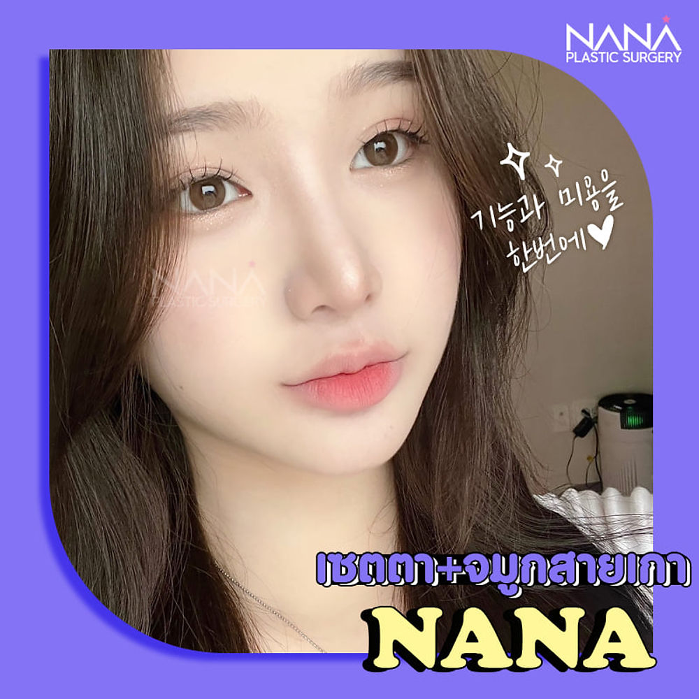 ศัลยกรรมจมูก