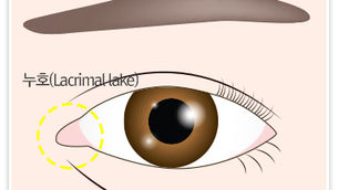 หากผ่าตัด ‘เปิดหัวตา’ มาก่อน สามารถแก้ไขได้หรือไม่?