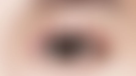 ศัลยกรรมตาด้วยเทคนิค เซเว่นลอค โรงพยาบาลไอดี