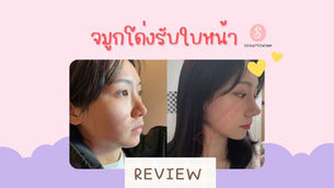 จมูกโด่งรับใบหน้า Deesse Plastic Surgery