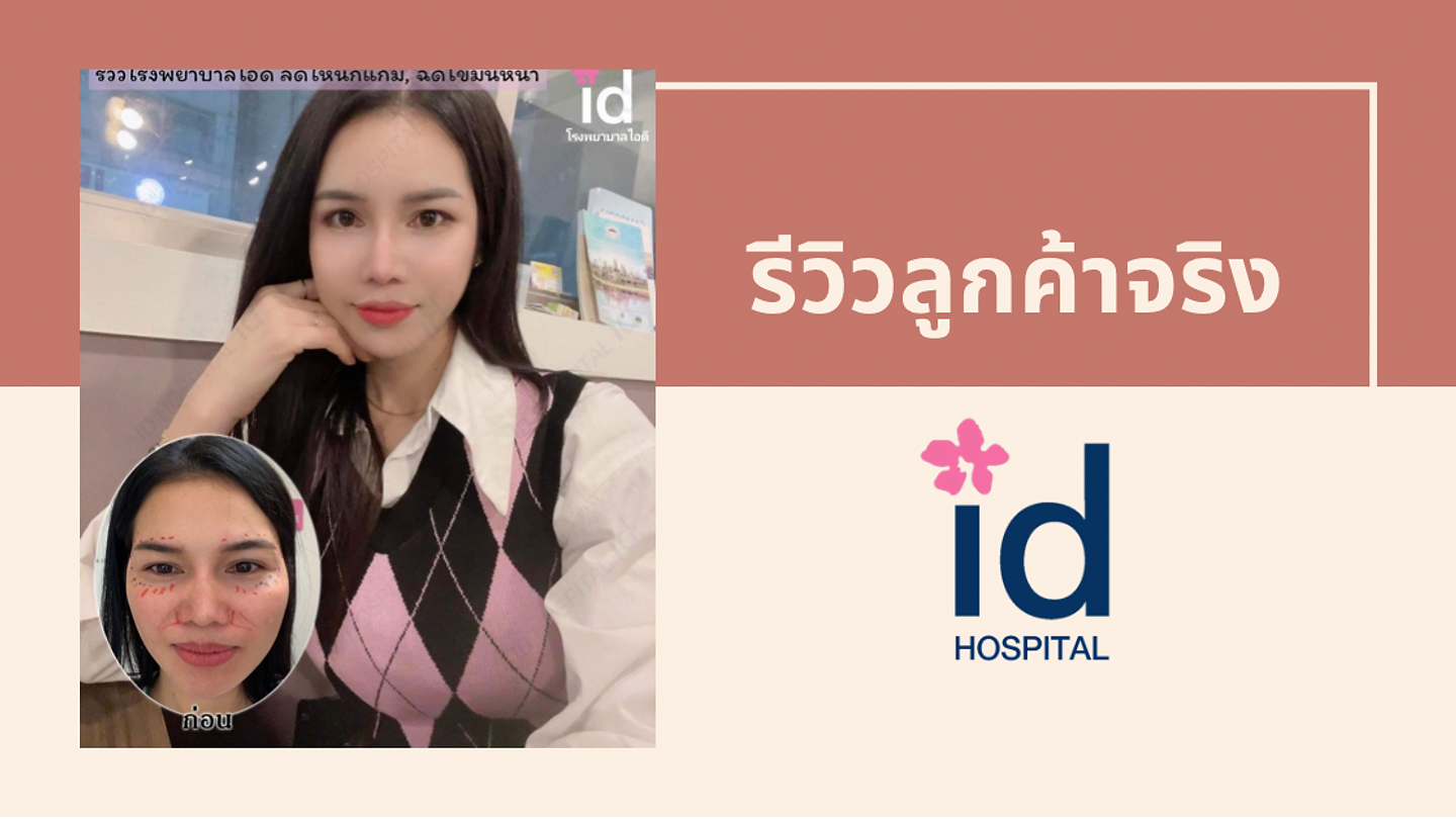 รีวิวศัลยกรรมโครงหน้า โรงพยาบาล ID (ตอนที่ 1)