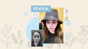 รีวิวศัลยกรรมเกาหลีเปลี่ยนโครงหน้า