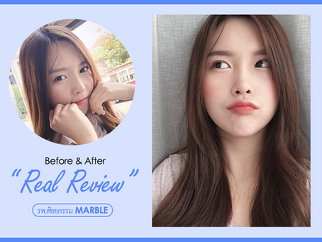 รีวิวแก้จมูกทรงสวย ครั้งเดียวจบ กับคุณภาวิตา