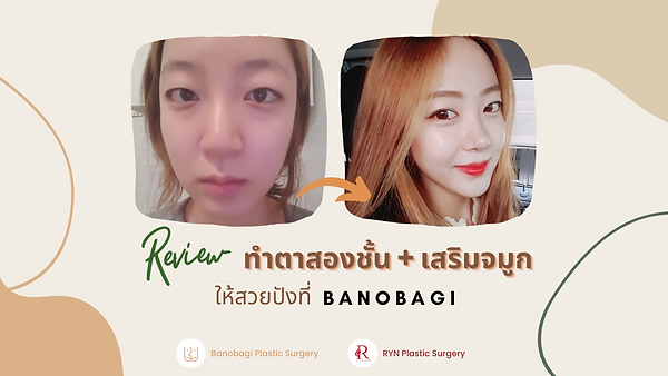 รีวิวทำตาสองชั้นพร้อมเสริมจมูกให้สวยปังที่ Banobagi (ตอนที่ 1)