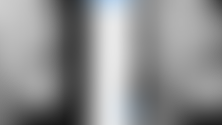 แศัลยแพทย์แนะนำ, เลือกวิธีศัลยกรรมคางหุบให้เหมาะสมกับแต่ละบุคคล