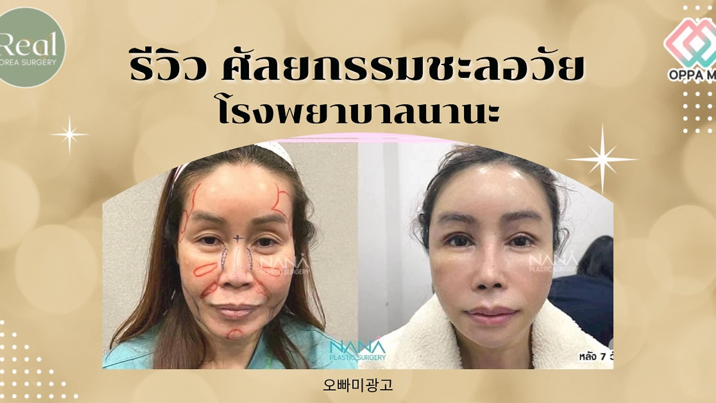 Before&After ศัลยกรรมชะลอวัย สุดยอดเทคนิคแห่ง รพ.นานะ (ตอนที่ 2)