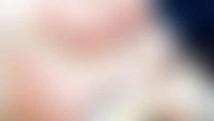 ผู้ป่วยโลหิตจางควรตรวจเลือด ก่อนตัดสินใจดูดไขมัน