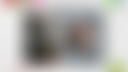 การผ่าตัดหนังตาบน สำหรับลูกค้าวัยกลางคน @Atop Plastic Surgery