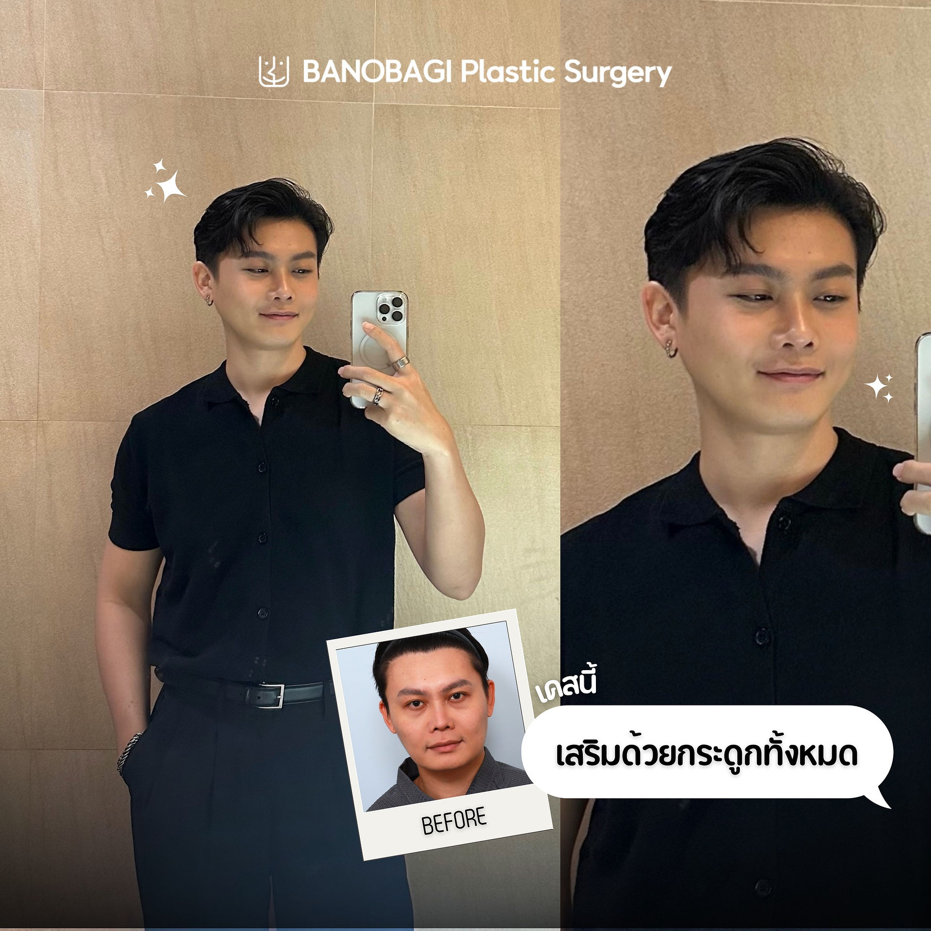 ธุรกิจเอเจนซี่ศัลยกรรมเกาหลี
