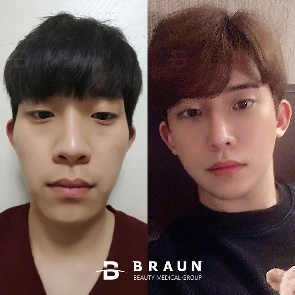 รีวิวศัลยกรรมผู้ชาย > โรงพยาบาลบราวน์ (Braun Plastic Surgery)