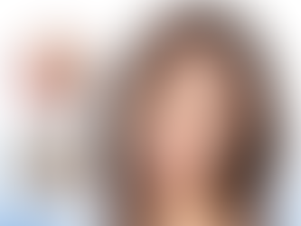 ศัลยกรรมโครงหน้า + ยกกระชับหน้าแบบ MACS Lift