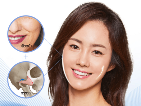 ศัลยกรรมโครงหน้า + ยกกระชับหน้าแบบ MACS Lift