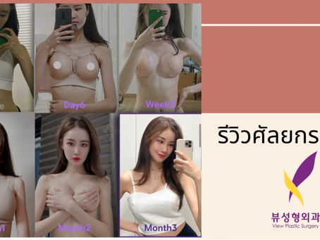 รีวิวศัลยกรรมหน้าอก โรงพยาบาล View