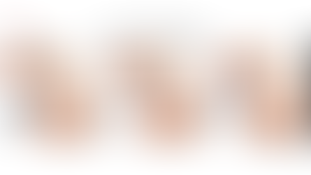 เสริมอึ๋ม เสียงต่อการเป็นมะเร็ง!!!!