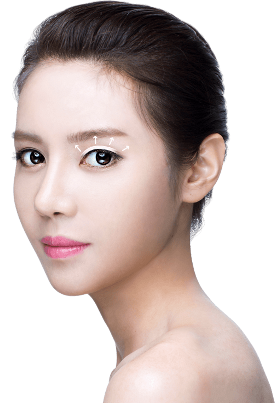 Incision double eyelid surgery model
