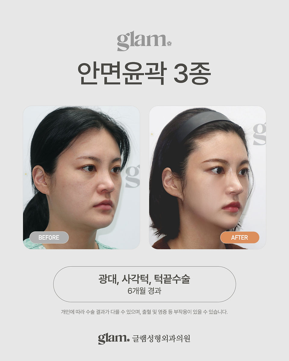 รีวิว Glam Plastic Surgery โรงพยาบาลผ่าตัดขากรรไกรและโครงหน้าเฉพาะทาง
