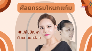 ศัลยกรรมโหนกแก้มแก้ไขปัญหาผิวหย่อนคล้อย