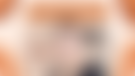 ศัลยกรรมโหนกแก้มแก้ไขปัญหาผิวหย่อนคล้อย