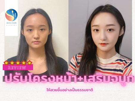 Review: ปรับโครงหน้า+เสริมจมูก ให้สวยขึ้นอย่างเป็นธรรมชาติ
