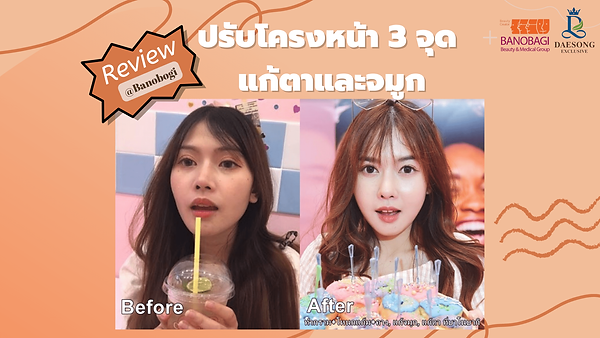 รีวิวปรับโครงหน้า 3 จุด แก้ตาและจมูกที่ Banonagi (ตอนที่ 1)