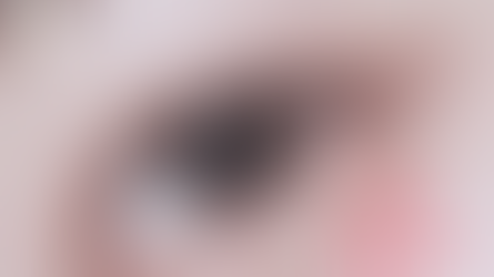 Q&A : หนังตาตกควรแก้ยังไง ศัลยกรรมอะไรช่วยได้บ้าง?