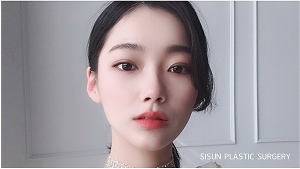 จัดการกับ ‘แผลเป็น’ หลังทำตาสองชั้นอย่างไรดี?! (ตอนที่ 2)