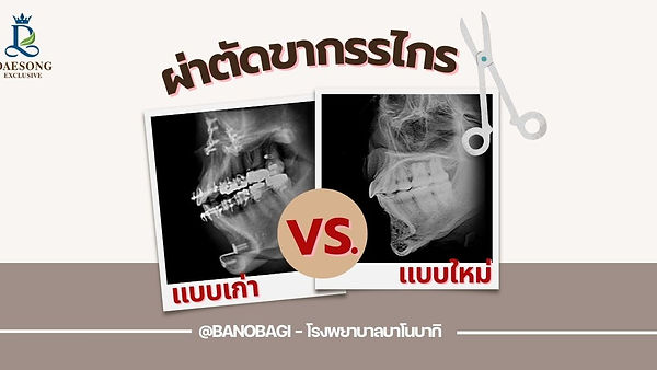 ผ่าตัดขากรรไกรแบบเก่า VS แบบใหม่ @banobagi