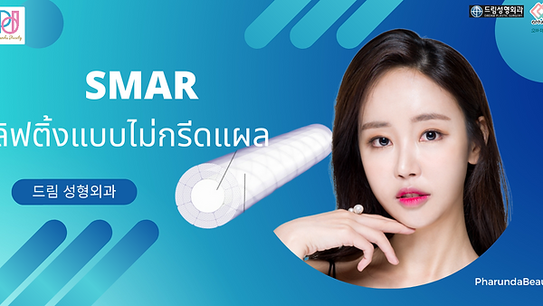 Dream SMAR ใบหน้ากระชับโดยไม่กรีดแผล
