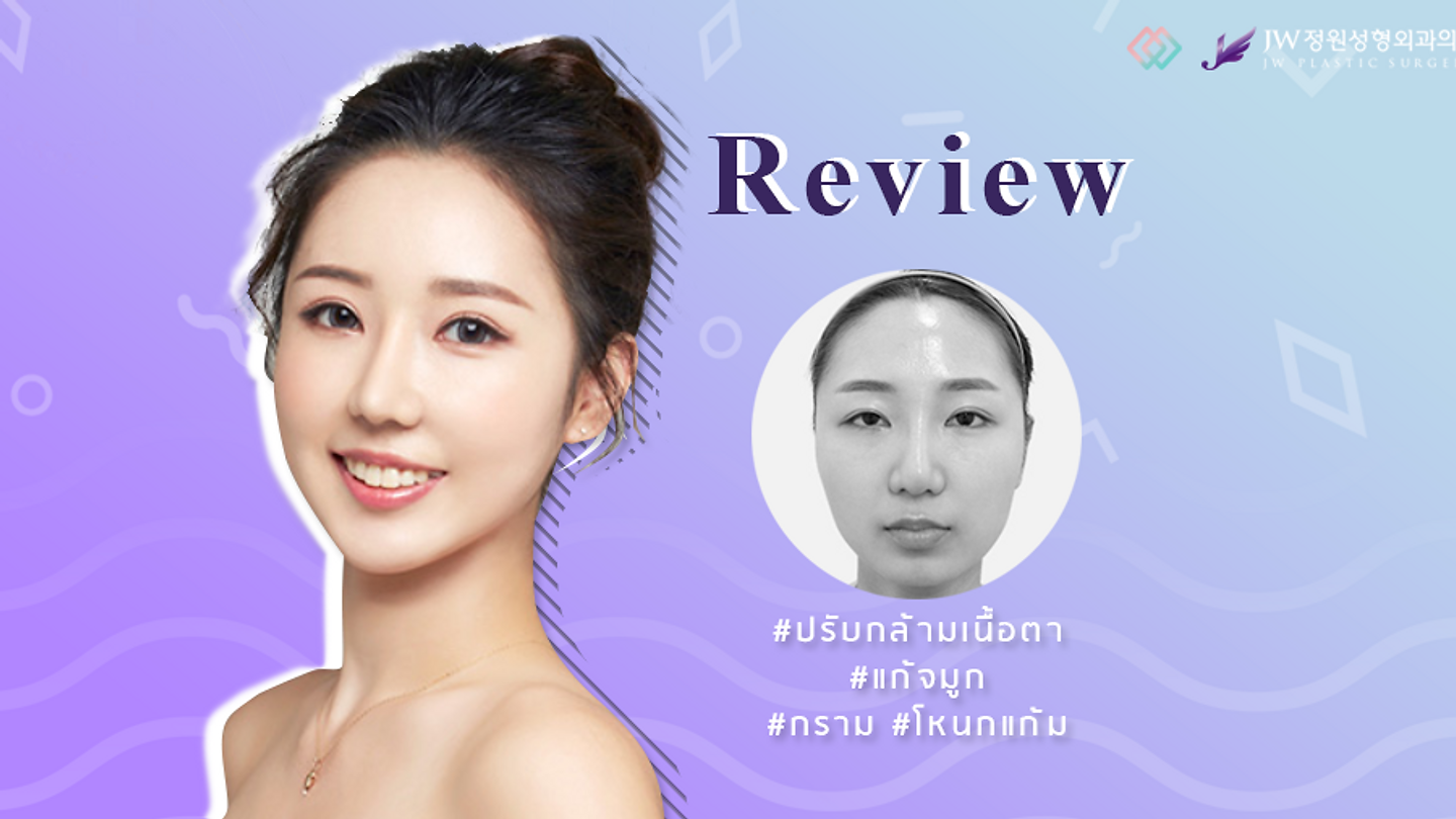 รีวิวปรับโครงหน้า แก้จมูก และปรับกล้ามเนื้อตา ของคิมซอนฮา (ตอนที่ 2)