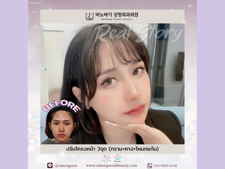 รีวิวโครงหน้า 3 จุด ที่บาโนบากิ