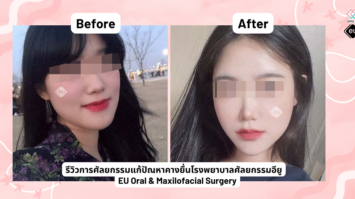 Cover image for the Korean plastic surgery hospitals section