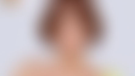 เสริมจมูกให้สวยขึ้นด้วยการทำปลายจมูกกับดีเซ่