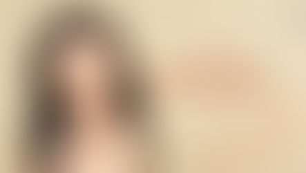 การผ่าตัดลดโหนกแก้มที่โรงพยาบาลไอดี