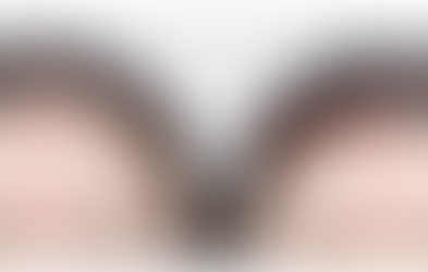 แก้ปัญหาหน้าผากกว้าง