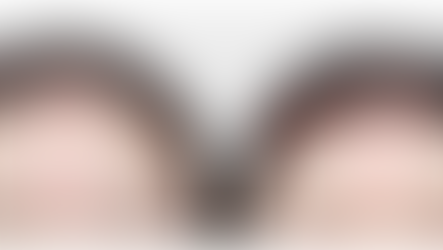 แก้ปัญหาหน้าผากกว้าง