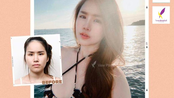 Real Review View Plastic Surgery