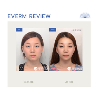 Everm Plastic Surgery (โรงพยาบาลศัลยกรรมขากรรไกรและโครงหน้าเอเวอร์เอ็ม)